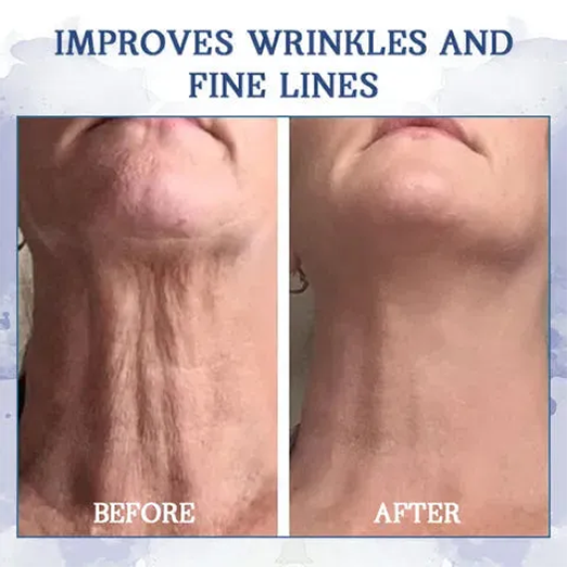 Seurico™ Advanced Firming & Wrinkle-Reducing Cream(Restore Skin Elasticity)