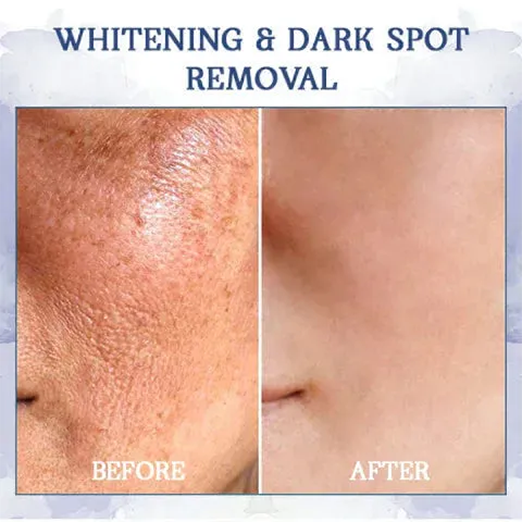 Seurico™ Advanced Firming & Wrinkle-Reducing Cream(Restore Skin Elasticity)
